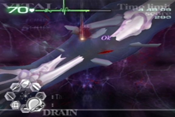 Trauma Center: Second Opinion  in-game screen image #1 